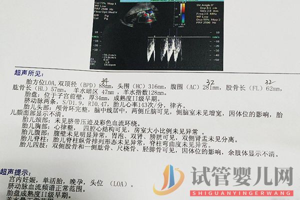 男孩女孩雙頂徑對照表(圖2)