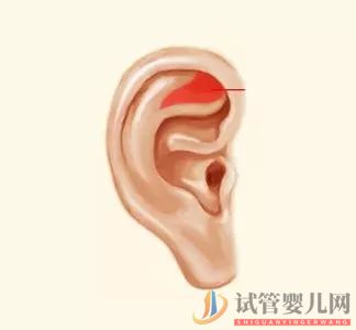 耳朵長這樣的人更長壽，這次中西醫觀點一致(圖6)