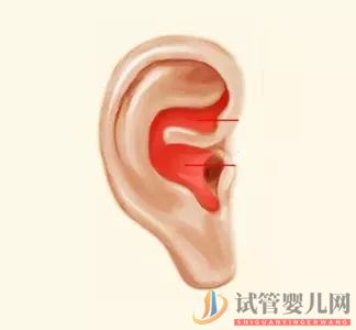 耳朵長這樣的人更長壽，這次中西醫觀點一致(圖5)