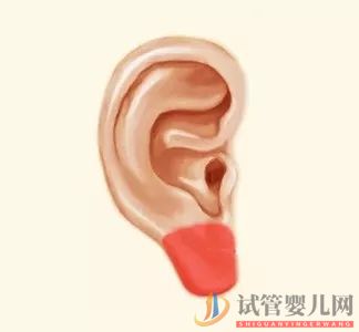 耳朵長這樣的人更長壽，這次中西醫觀點一致(圖4)