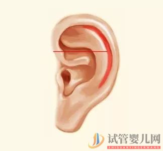 耳朵長這樣的人更長壽，這次中西醫觀點一致(圖7)