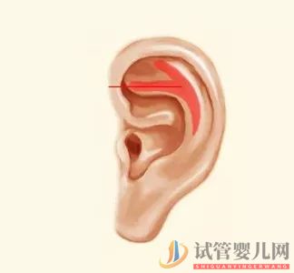 耳朵長這樣的人更長壽，這次中西醫觀點一致(圖8)
