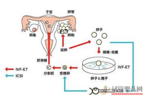 試管嬰兒具體流程(圖3)