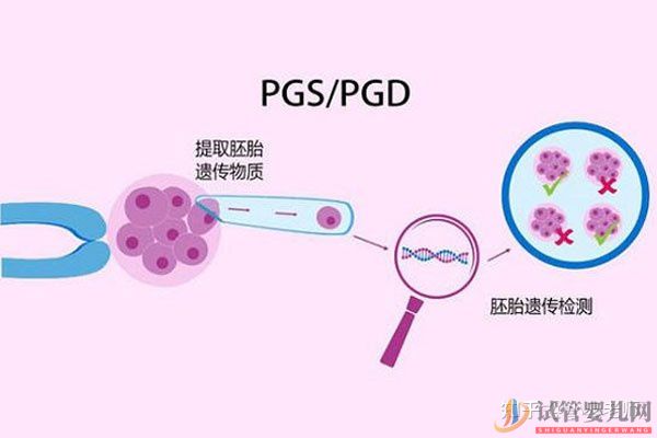 全面解讀一代、二代、三代試管嬰兒的區別(圖4)