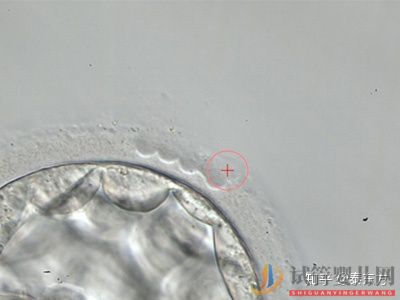 試管嬰兒成功必備的自身條件有什么？(圖1)