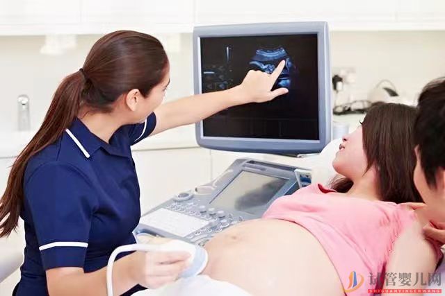 試管嬰兒醫生為什么會頻繁的要求女性做B超(圖3)