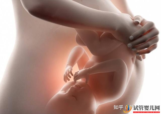 廣州試管嬰兒多少錢一次_為什么醫(yī)生不建議做雙胞胎(圖3)