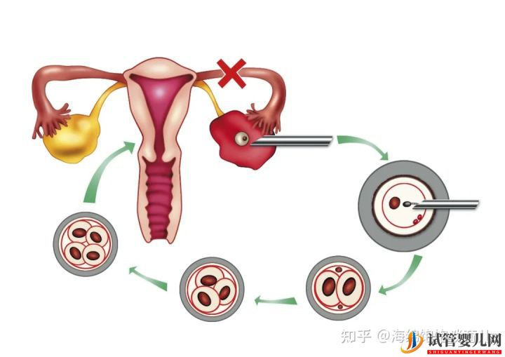 試管嬰兒1代、2代、3代、4代哪個最好(圖2)