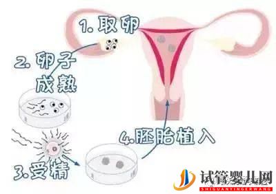 試管嬰兒的一個基本流程和周期時間(圖2) 試管嬰兒的一個基本流程和周期時間(圖2)