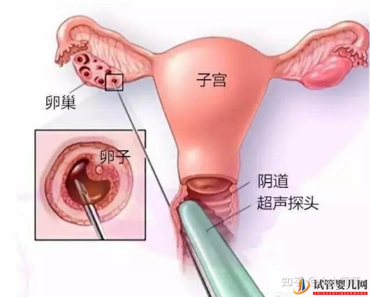 試管嬰兒流程&費用(圖3) 試管嬰兒流程&費用(圖3)