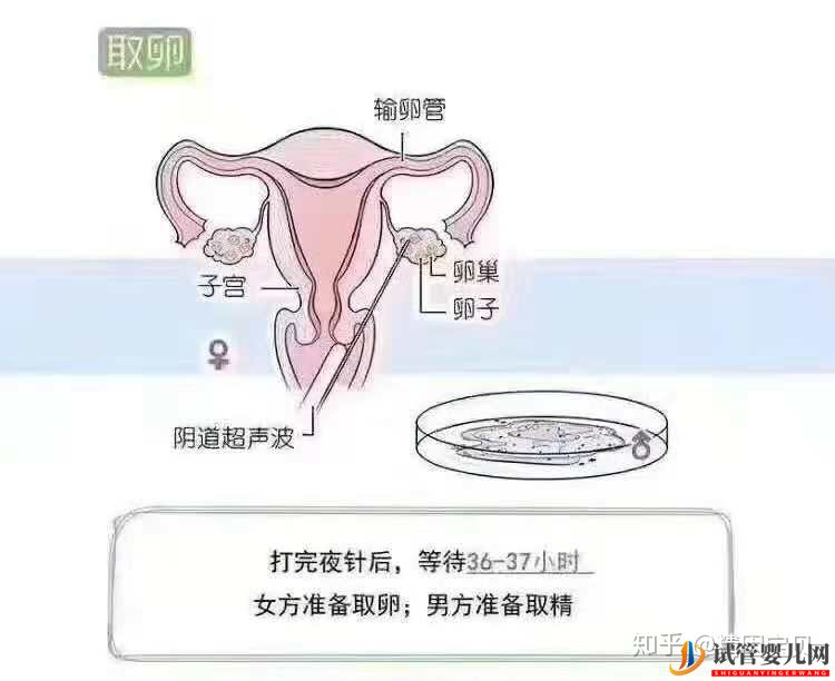 試管嬰兒流程圖,拿走不謝(圖4)