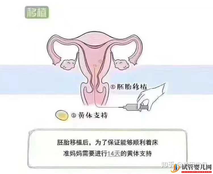 試管嬰兒流程圖,拿走不謝(圖6)