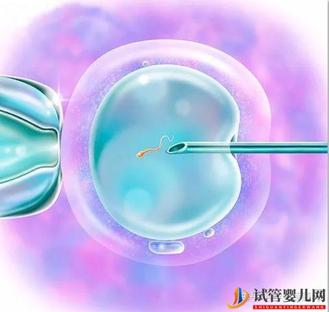 試管嬰兒怎么做的全過程_做試管嬰兒的流程(圖1)