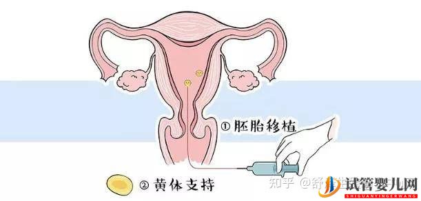 一個(gè)試管嬰兒周期多長(zhǎng)時(shí)間,具體流程怎么樣(圖9) 一個(gè)試管嬰兒周期多長(zhǎng)時(shí)間,具體流程怎么樣(圖9)