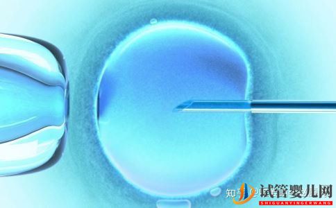 什么是試管受精試管受精的具體步驟有哪些(圖1) 什么是試管受精試管受精的具體步驟有哪些(圖1)