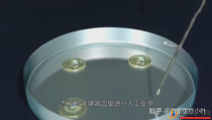做試管嬰兒有多痛,幾張3D模擬圖,看完全過程后心(圖5) 做試管嬰兒有多痛,幾張3D模擬圖,看完全過程后心(圖5)