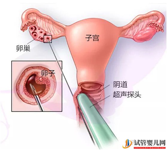 做試管卵泡正常內膜厚度多少才正常_90%的患者不知道(圖3) 做試管卵泡正常內膜厚度多少才正常_90%的患者不知道(圖3)