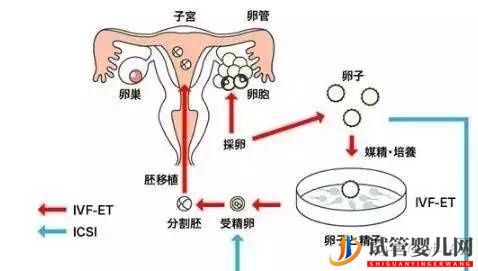 試管嬰兒的歷史及其發展過程(圖8) 試管嬰兒的歷史及其發展過程(圖8)