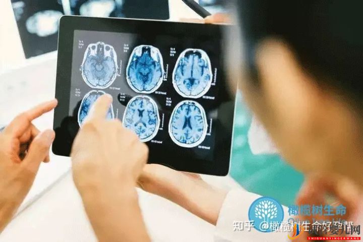 試管嬰兒必查項目性激素六項報告數(shù)值逐個(圖6)