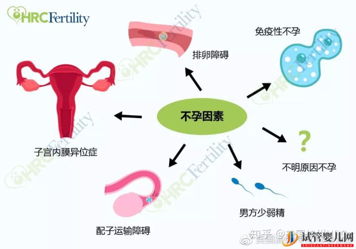 原來美國試管是這樣的美國試管(圖3)