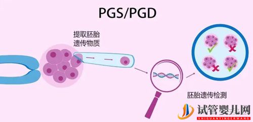 探索美國試管嬰兒費用清單(圖2)