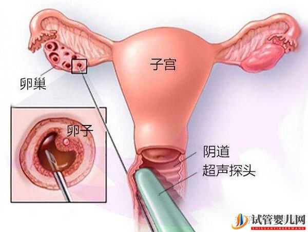 美國試管專家提高試管成功率的有效方案(圖7) 美國試管專家提高試管成功率的有效方案(圖7)