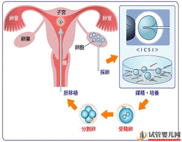 美國試管專家講解人工授精和試管嬰兒的區別(圖3)