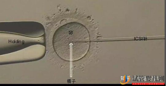 銅仁第三代試管嬰兒費用是多少,大致的流程有哪些(圖2)