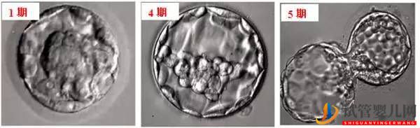 手把手教你搞懂試管嬰兒的胚胎等級(圖2)