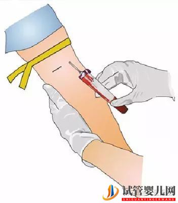 試管周期是什么意思_一個周期要多久(圖4) 試管周期是什么意思_一個周期要多久(圖4)