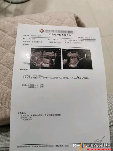 試管媽媽來教你_試管已生男孩的總結(jié)!(圖2)