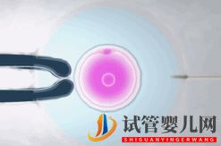 做試管嬰兒到底要花多少錢(qián)_幾萬(wàn)和十幾萬(wàn)有什么區(qū)別(圖10) 做試管嬰兒到底要花多少錢(qián)_幾萬(wàn)和十幾萬(wàn)有什么區(qū)別(圖10)