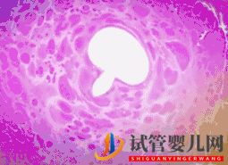 做試管嬰兒到底要花多少錢(qián)_幾萬(wàn)和十幾萬(wàn)有什么區(qū)別(圖12) 做試管嬰兒到底要花多少錢(qián)_幾萬(wàn)和十幾萬(wàn)有什么區(qū)別(圖12)