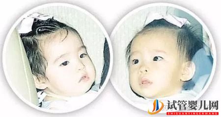 原來這些漂亮明星寶寶都是試管嬰兒!盤點(diǎn)那些做試管(圖7) 原來這些漂亮明星寶寶都是試管嬰兒!盤點(diǎn)那些做試管(圖7)