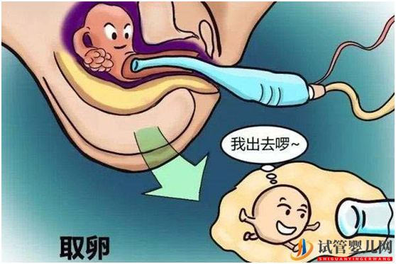很多人都忽略了大齡做試管嬰兒的這些好處(圖1) 很多人都忽略了大齡做試管嬰兒的這些好處(圖1)