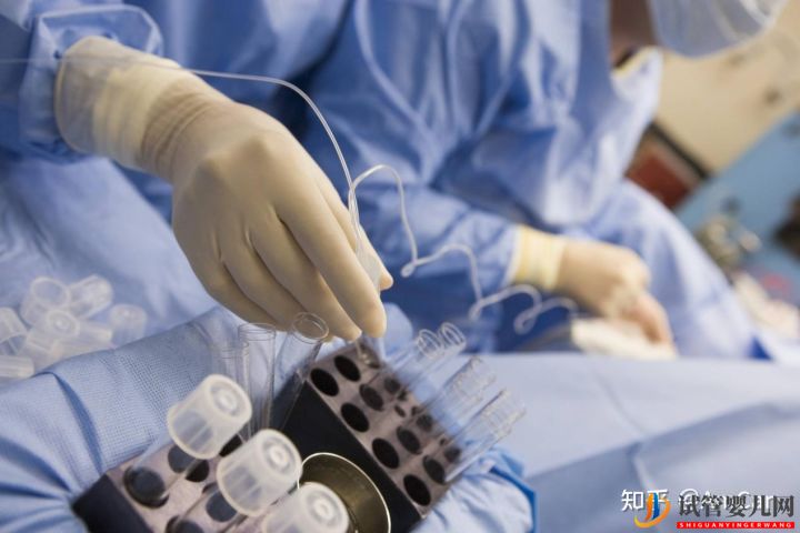 試管嬰兒大揭秘,取卵疼不疼(圖2) 試管嬰兒大揭秘,取卵疼不疼(圖2)