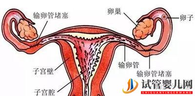 輸卵管堵塞還想懷寶寶!能夠做泰國試管嬰兒嗎(圖1) 輸卵管堵塞還想懷寶寶!能夠做泰國試管嬰兒嗎(圖1)