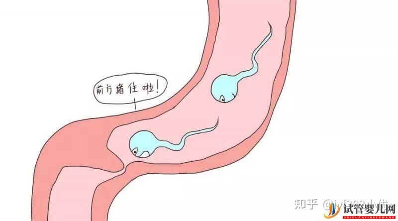 輸卵管堵塞想做試管嬰兒,拿到結(jié)果后我哭了(圖3) 輸卵管堵塞想做試管嬰兒,拿到結(jié)果后我哭了(圖3)