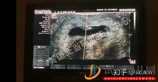 試管嬰兒寶寶VS自然受孕寶寶(圖1) 試管嬰兒寶寶VS自然受孕寶寶(圖1)