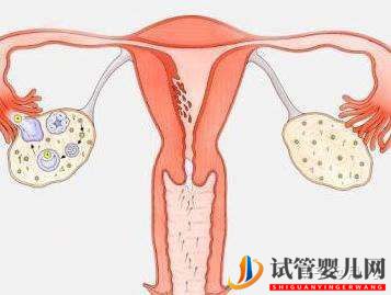 試管嬰兒超詳細(xì)全流程(圖3)