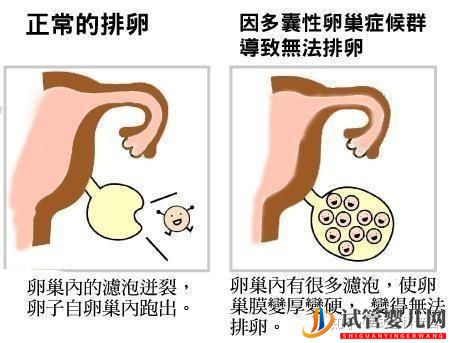 試管嬰兒成功誕生有多難(圖6) 試管嬰兒成功誕生有多難(圖6)