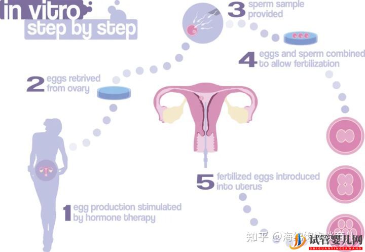 試管嬰兒1代、2代、3代、4代哪個最好_真實操作過(圖1)