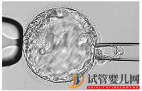 第三代試管嬰兒真的最好最先進(jìn)嗎_國(guó)內(nèi)哪里可以做(圖6) 第三代試管嬰兒真的最好最先進(jìn)嗎_國(guó)內(nèi)哪里可以做(圖6)