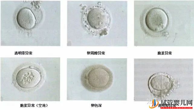 夫妻染色體正常,但胚胎染色體異常,什么原因引起(圖5)