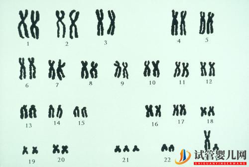 夫妻染色體正常，試管胚胎染色體異常的三個原因你都知道嗎？(圖1)