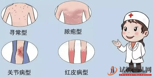 恭喜你，出現這些跡象，說明你的銀屑病正在好轉！(圖1)