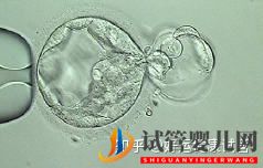 三代試管知男女的必經(jīng)之路—胚胎活檢術(shù)(圖4)