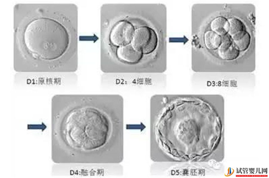 看完這篇試管嬰兒養囊的利弊，你會繼續選擇養囊嗎？(圖1)