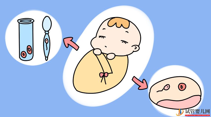做試管嬰兒會痛嗎？需要打麻醉嗎？(圖1)