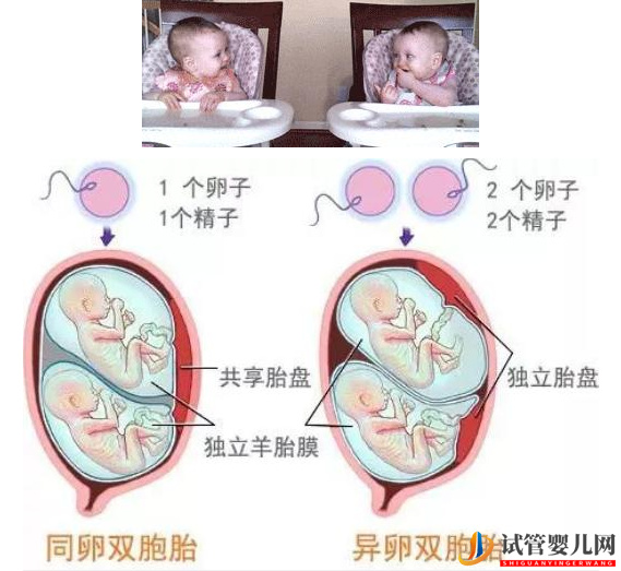 哪類人更容易生雙胞胎呢？做試管雙胞胎包成功行嗎？(圖1)